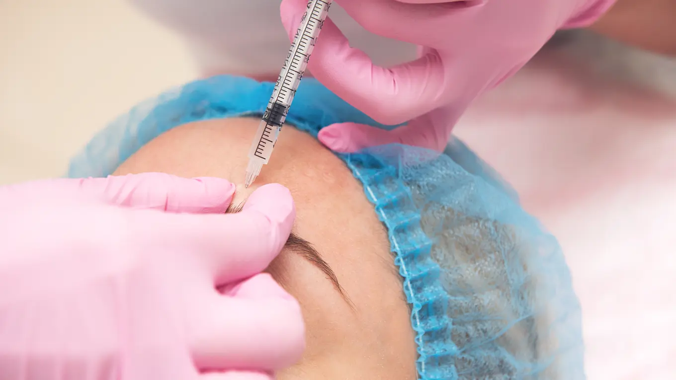 cosmetic injection to forehead with syringe