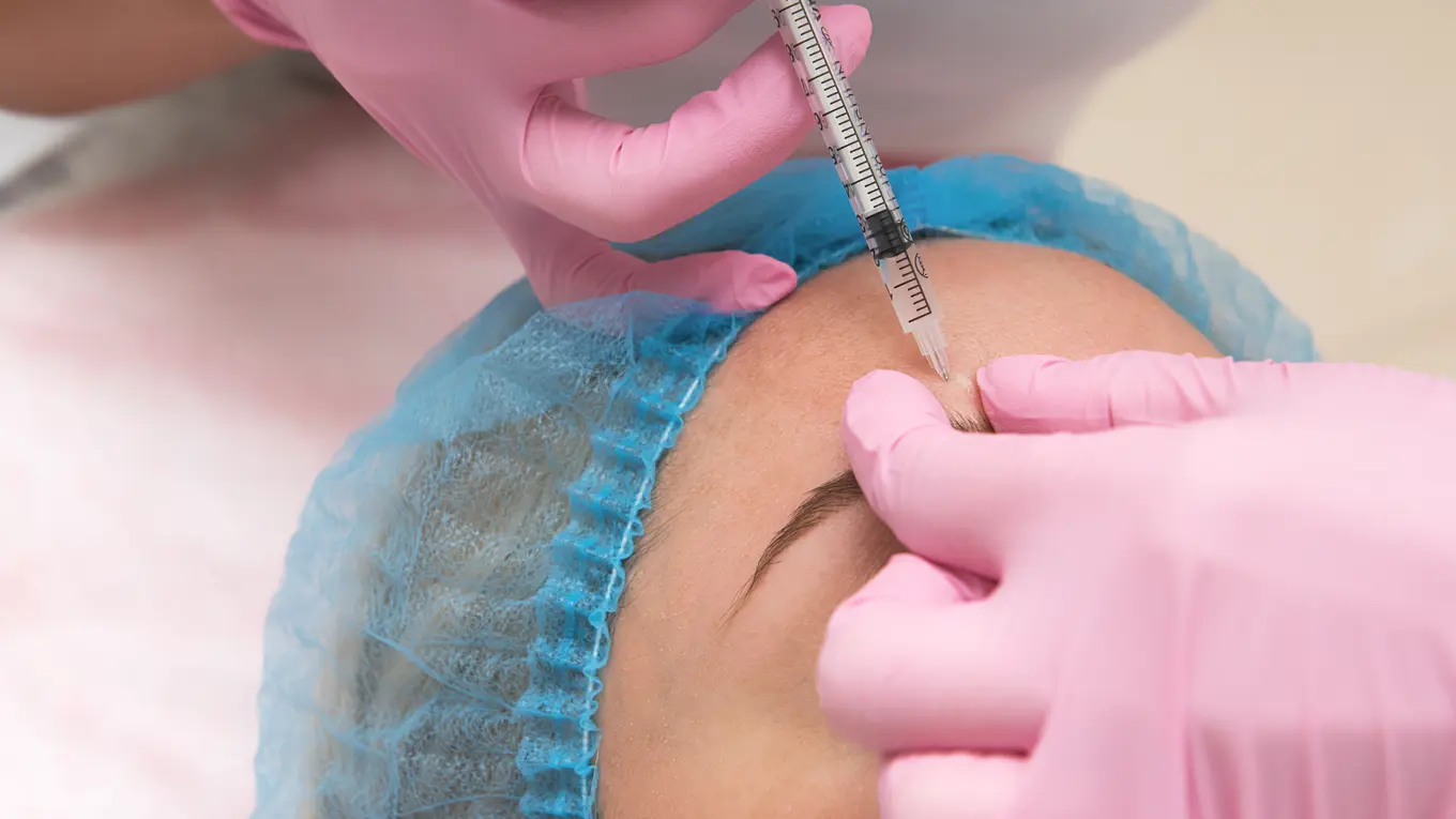 cosmetic injection to forehead with syringe