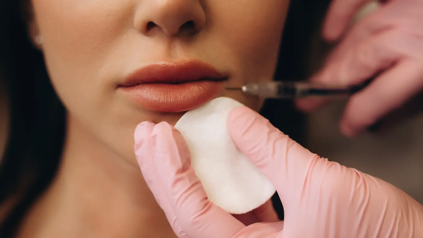 Close up of lip filler injection procedure